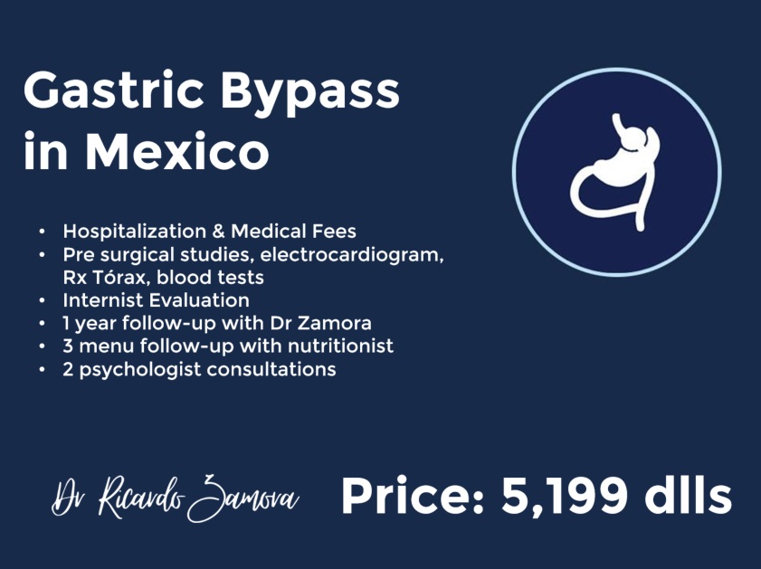 gastric bypass price in mexicali mexico